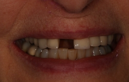 Smile Gallery - Church Road Dental and Cosmetic
