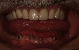 Smile Gallery - Church Road Dental and Cosmetic