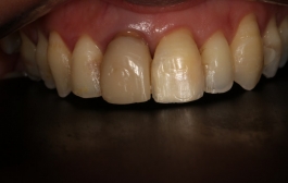 Smile Gallery - Church Road Dental and Cosmetic