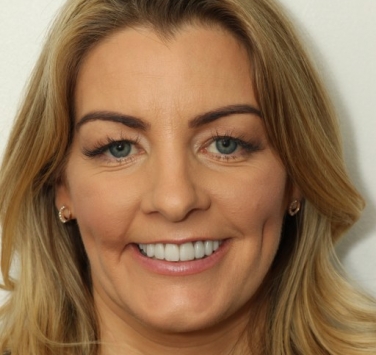 Smile Gallery - Church Road Dental and Cosmetic