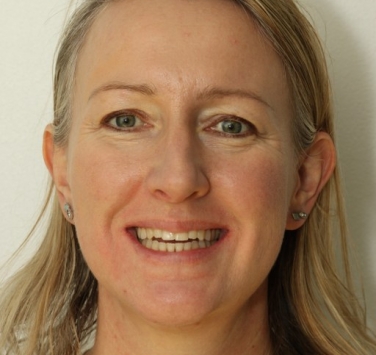 Smile Gallery - Church Road Dental and Cosmetic