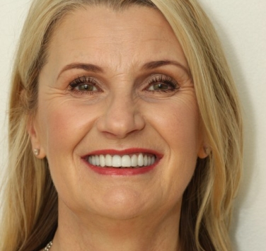 Smile Gallery - Church Road Dental and Cosmetic