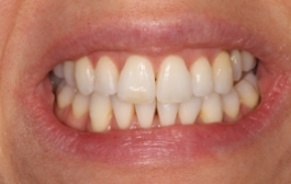 Smile Gallery - Church Road Dental and Cosmetic