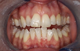 Smile Gallery - Church Road Dental and Cosmetic