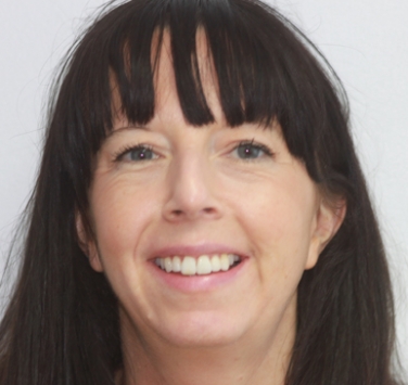 Smile Gallery - Church Road Dental and Cosmetic