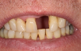 Smile Gallery - Church Road Dental and Cosmetic