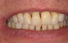 Smile Gallery - Church Road Dental and Cosmetic