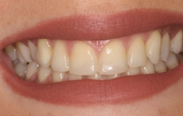 Smile Gallery - Church Road Dental and Cosmetic