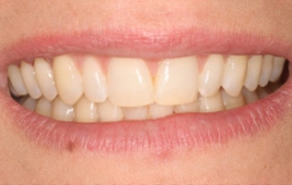 Smile Gallery - Church Road Dental and Cosmetic