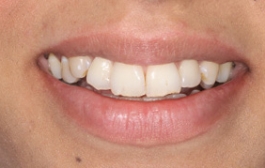 Smile Gallery - Church Road Dental and Cosmetic