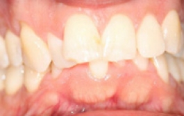 Smile Gallery - Church Road Dental and Cosmetic