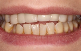 Smile Gallery - Church Road Dental and Cosmetic