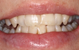 Smile Gallery - Church Road Dental and Cosmetic