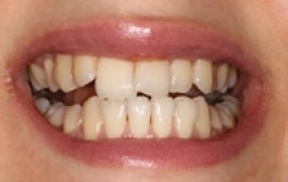 Smile Gallery - Church Road Dental and Cosmetic