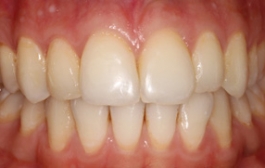Smile Gallery - Church Road Dental and Cosmetic