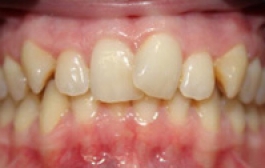 Smile Gallery - Church Road Dental and Cosmetic