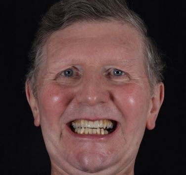 Smile Gallery - Church Road Dental and Cosmetic