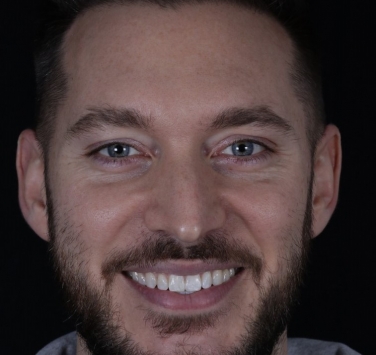 Smile Gallery - Church Road Dental and Cosmetic