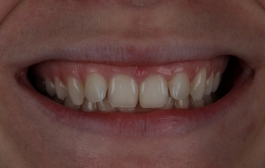 Smile Gallery - Church Road Dental and Cosmetic