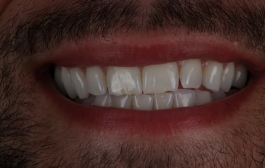 Smile Gallery - Church Road Dental and Cosmetic