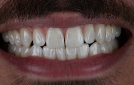 Smile Gallery - Church Road Dental and Cosmetic