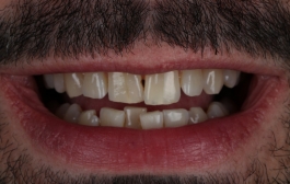 Smile Gallery - Church Road Dental and Cosmetic