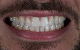 Smile Gallery - Church Road Dental and Cosmetic