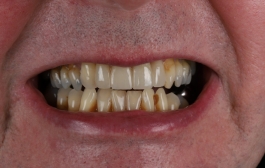 Smile Gallery - Church Road Dental and Cosmetic