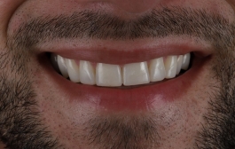 Smile Gallery - Church Road Dental and Cosmetic