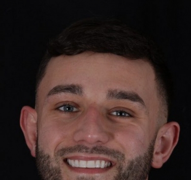 Smile Gallery - Church Road Dental and Cosmetic