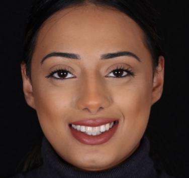 Smile Gallery - Church Road Dental and Cosmetic
