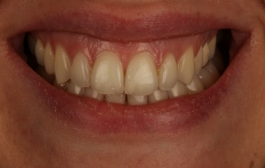 Smile Gallery - Church Road Dental and Cosmetic