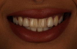 Smile Gallery - Church Road Dental and Cosmetic