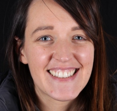 Smile Gallery - Church Road Dental and Cosmetic