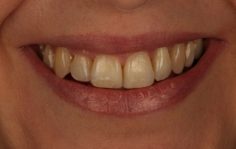 Smile Gallery - Church Road Dental and Cosmetic