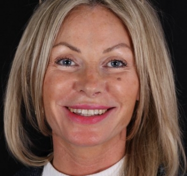Smile Gallery - Church Road Dental and Cosmetic