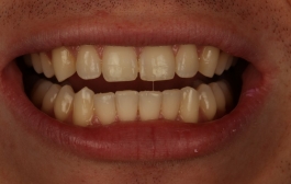 Smile Gallery - Church Road Dental and Cosmetic